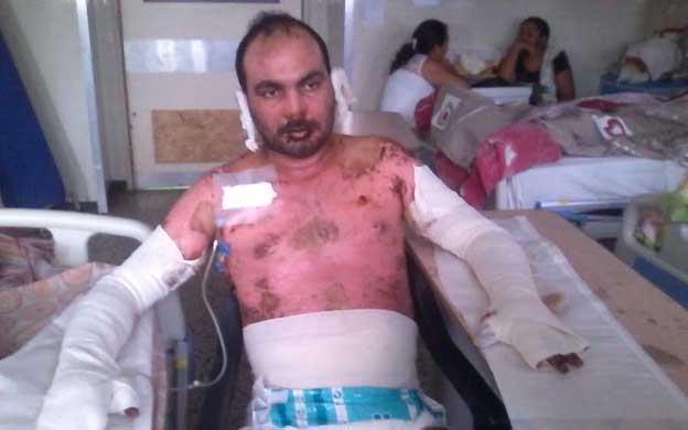 Josu00e9 Luis Varela se recupera en el Hospital Universitario de Maracaibo. (Foto: Cortesu00eda)