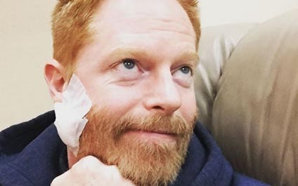 Actor de "Modern Family" es operado de cáncer