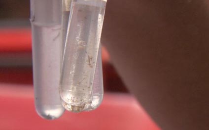El zika en Venezuela, pica y se extiende