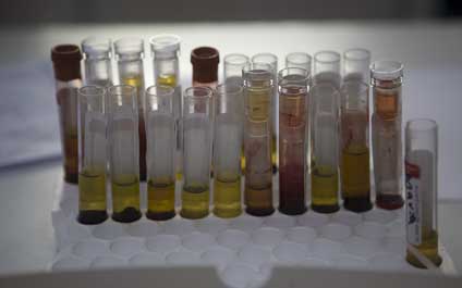 Confirman transmisión del zika por contacto sexual