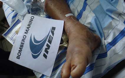 Alertan sobre las serpientes en las áreas rurales