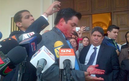 Diputado opositor recibe botellazo a las afueras de la AN