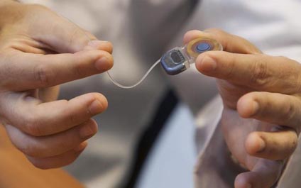 Científicos crean revestimiento de implantes antibacteriano
