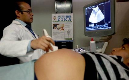 Descartan que zika llegue al feto a través de células de la placenta