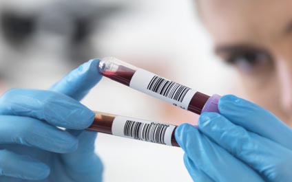 También necesitamos del colesterol malo y los triglicéridos
