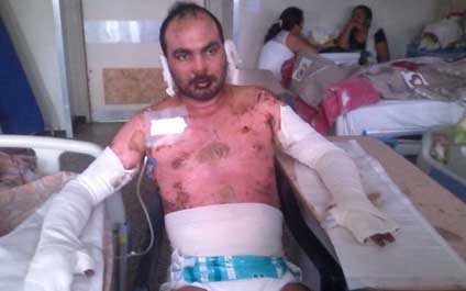 “Fui víctima de una mujer posesiva” 