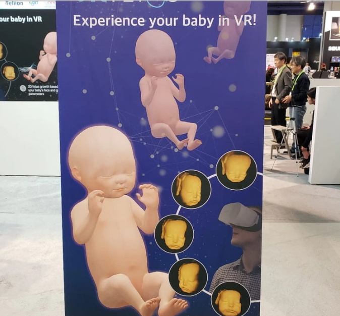 Presentan ecografías en 3D y 4D 