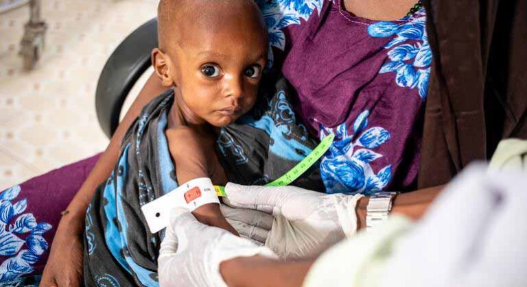 Advierten incremento de la desnutrición infantil en el país