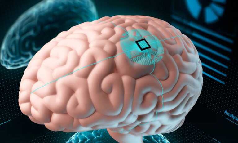 Instalan primer implante a ser humano para controlar computadora