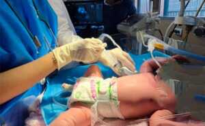 Operan en el HUM a neonato con patología que afecta a 1 de cada 15 mil