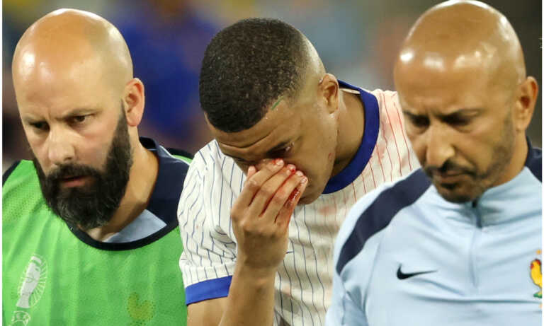 Mbappé se fractura la nariz y disputará la Eurocopa con máscara