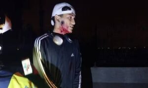 Secuestran y balean a venezolano acusado de extorsionar a mujeres en Lima