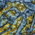 Foto de microscopio difundida por el Instituto Nacional de Alergias y Enfermedades Infecciosas de Estados Unidos el 26 de marzo del 2024, que muestra partículas de la gripe aviar. (CDC/NIAID via AP)