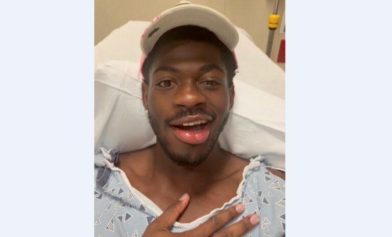 Hospitalizan al rapero Lil Nas X por una parálisis facial