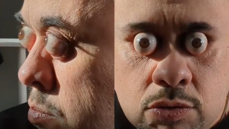Hombre uruguayo rompe récord Guinness con extraño talento ocular