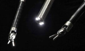 Robot con IA opera una vesícula biliar sin asistencia humana