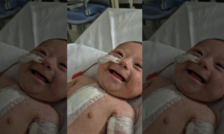 “Balta” supera operación cardiaca y su tierna sonrisa emociona a millones