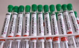 MinSalud confirma 3 muertes por hantavirus en Anzoátegui