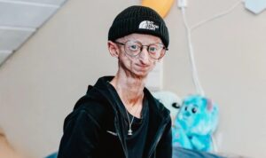 Muere Michiel Vandeweert, el influencer que dio visibilidad a la progeria