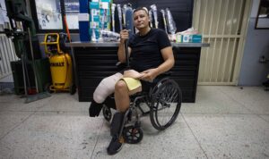 Amputado tras el terremoto en La Guaira: “Sentí que ya el pie no lo tenía”
